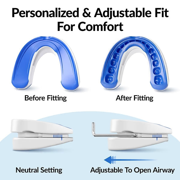 BREASEZ® Adjustable Anti-Snoring Mouthpiece