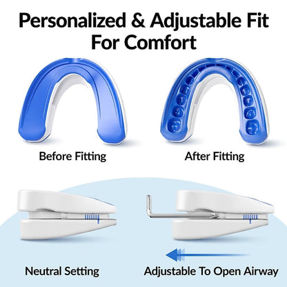 BREASEZ® Adjustable Anti-Snoring Mouthpiece